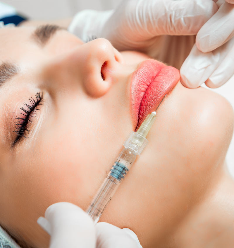 Lip Fillers & Dermal Fillers