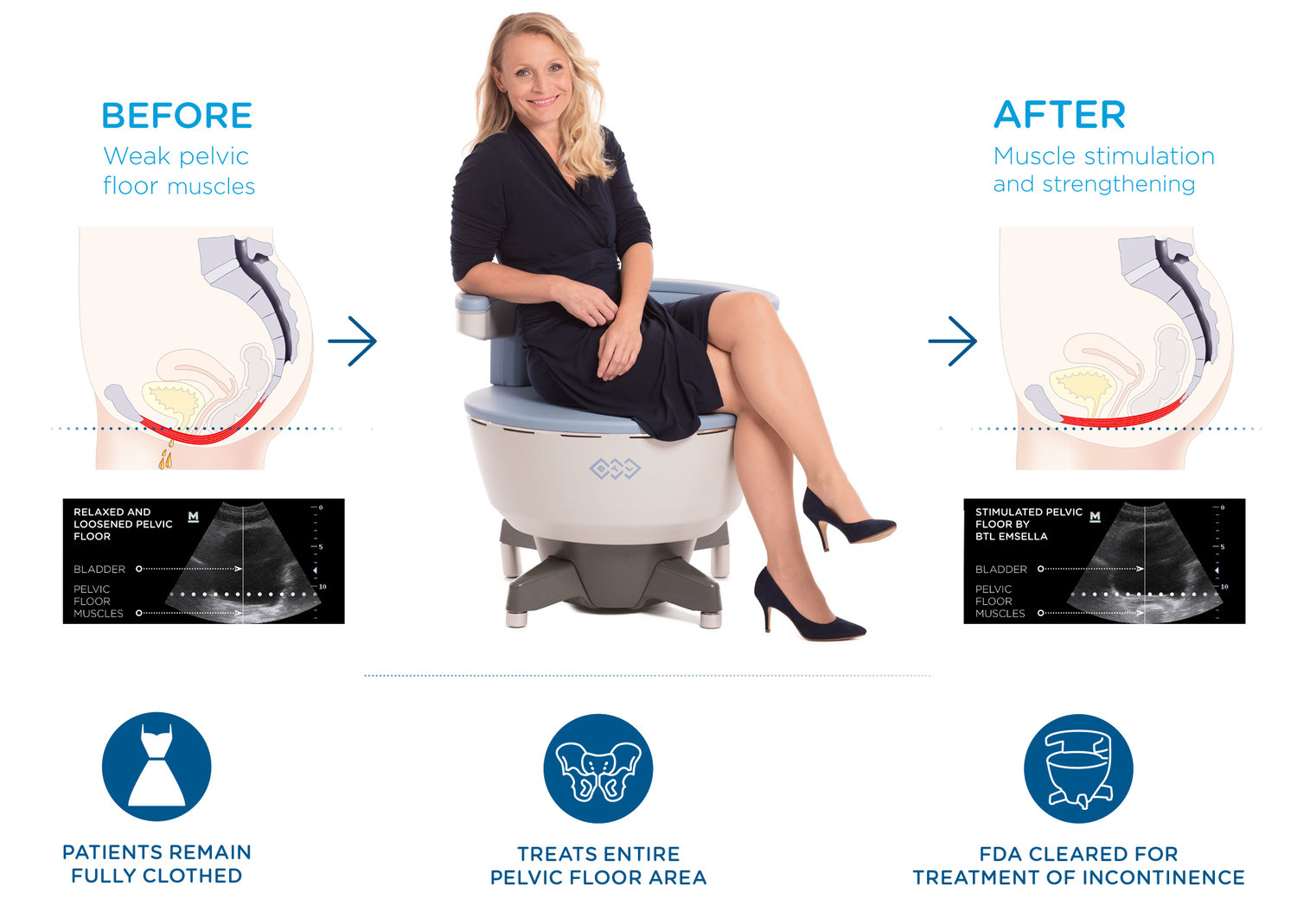 Pelvic Chair Therapy