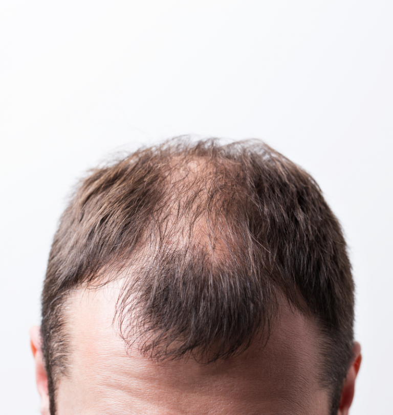 Services Restorations Medical Spa